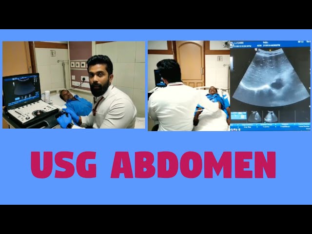 USG Abdomen || Organomegaly