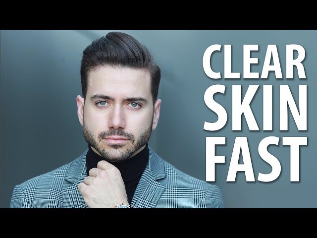 HOW TO GET CLEAR SKIN FAST | Men's Skincare Routine | ALEX COSTA
