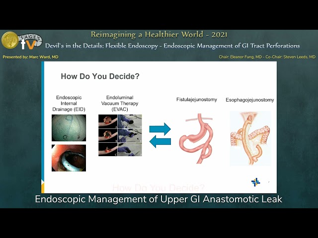 Endoscopic Management of Upper GI Anastomotic Leak