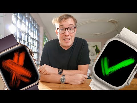 Grösster Fehler, bester Tipp zur Apple Watch