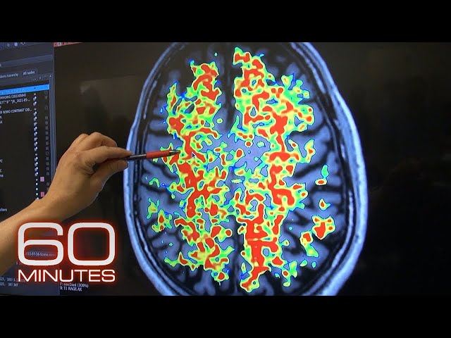 The hope for early detection of Alzheimer's disease