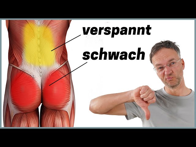 Die häufigste Ursache für Rückenschmerzen (Anatomie erklärt)