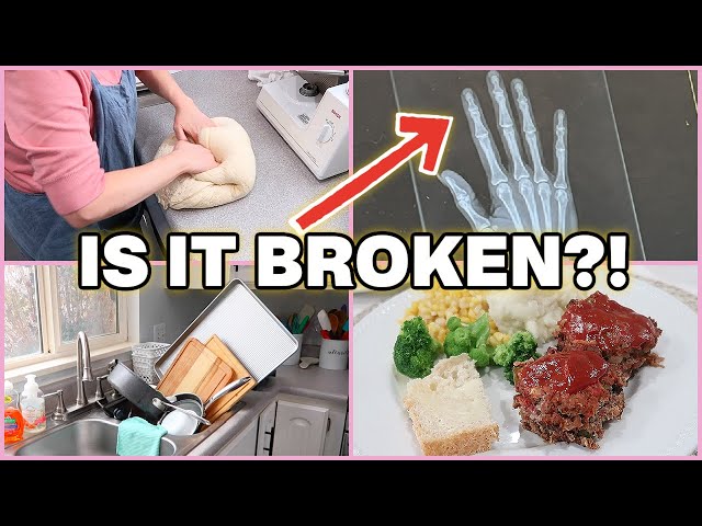 Homemaker Life, With A Broken Finger?
