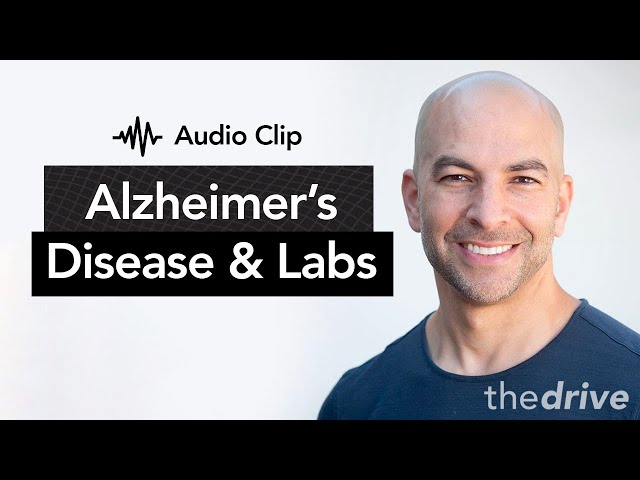 Alzheimer’s Disease — What Labs Can Tell You About Your Risk | Peter Attia, M.D.