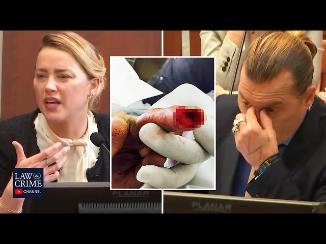 Amber Heard Tells FULL Story of Australia Incident with Johnny Depp That Severed His Finger