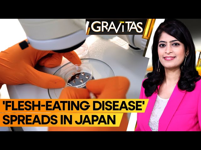 Gravitas: 'Flesh-eating disease' spreading at record rate in Japan