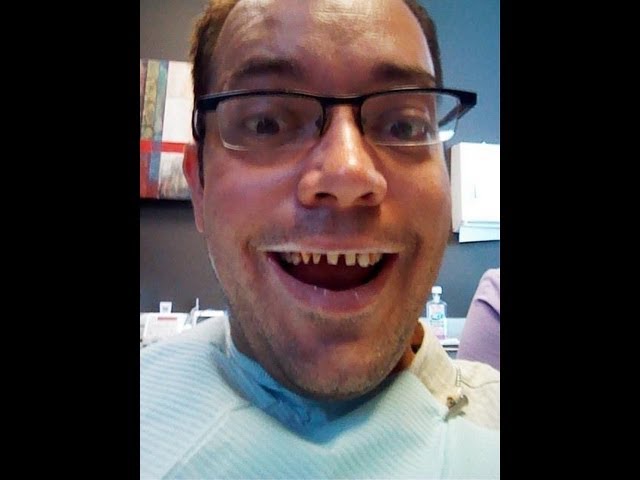 Porcelain Tooth Crowns, Cosmetic Dentistry, My New Smile, And The Dentist's Chair