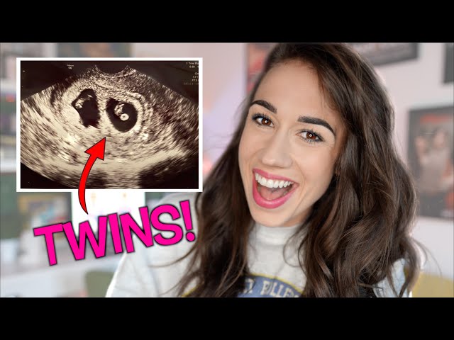 I'M PREGNANT WITH TWINS!