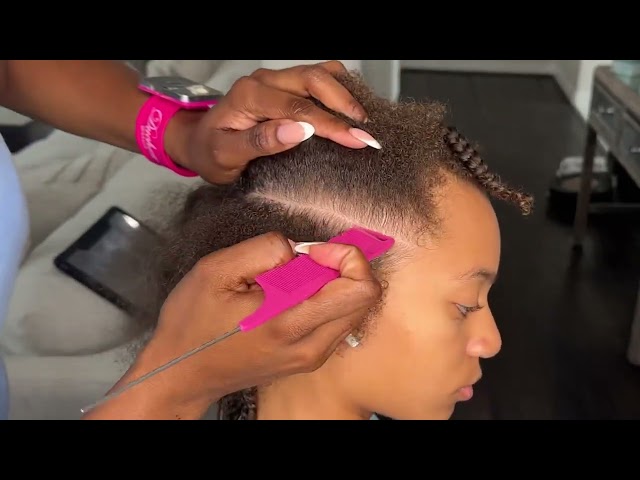 Why My Daughters Hair Fell Out | She Wants Locs Now | What We're Doing To Grow It Back