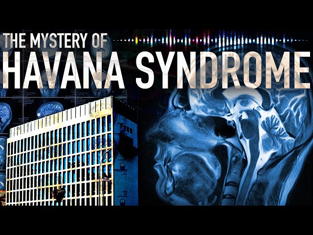 What is Havana Syndrome? The Mysterious Illness in U.S. Embassies