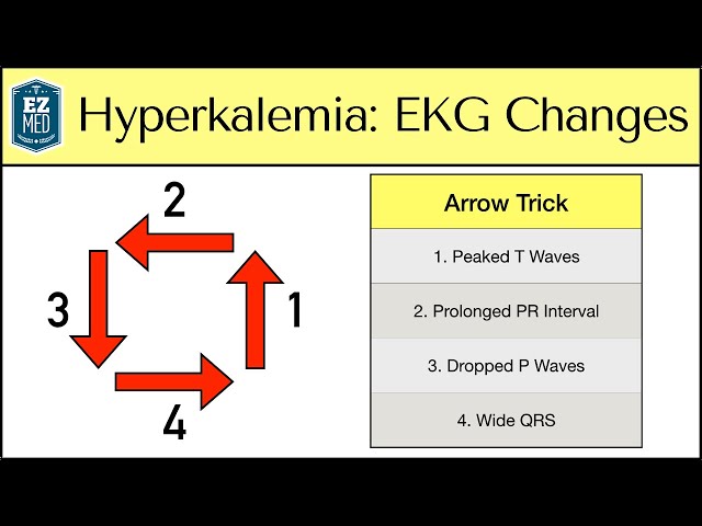 Hyperkalemia ECG Changes: EASY TRICK! [Mechanism Explained]