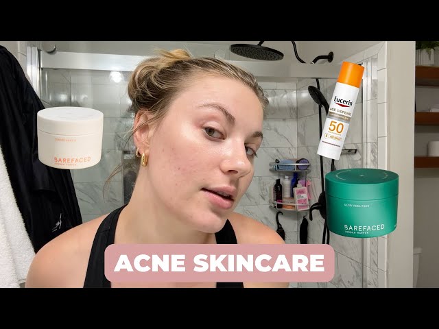 UPDATED SKINCARE ROUTINE FOR ACNE