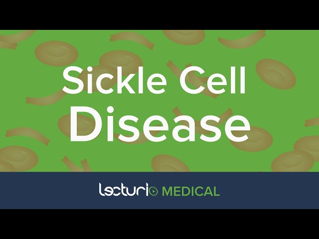 Sickle Cell (Hemoglobin SS) Disease: Acute & Chronic Presentation | Pediatrics