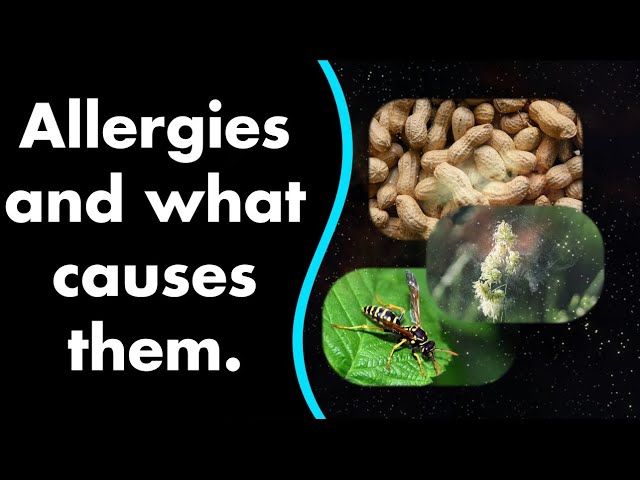 Allergies and what causes them