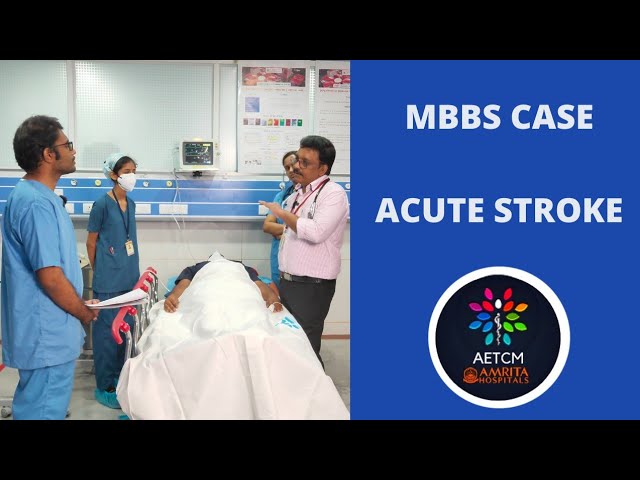MBBS Case Discussion || Stroke || CNS Examination || Hemiplegia