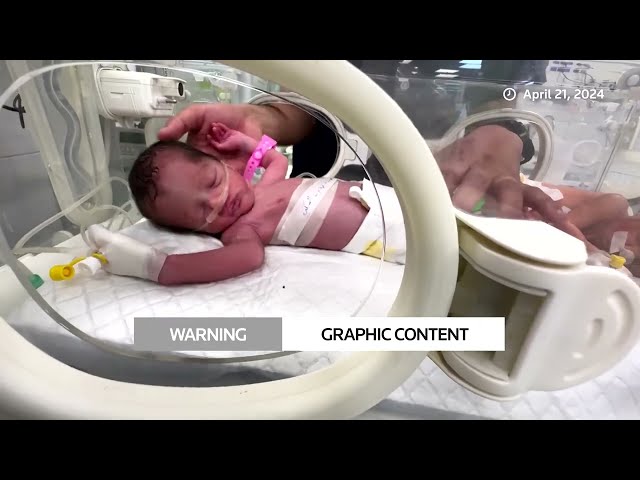 GRAPHIC WARNING: Gazan baby saved from her dead mother's womb dies | REUTERS