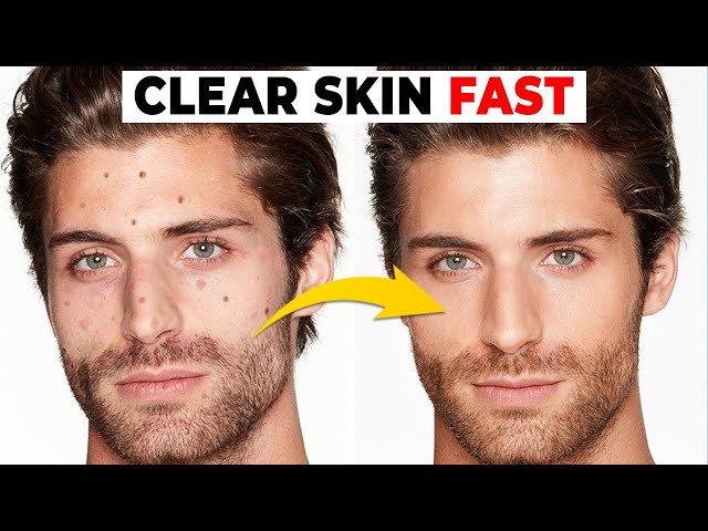 5 Habits That Are DESTROYING Your Skin | Alex Costa