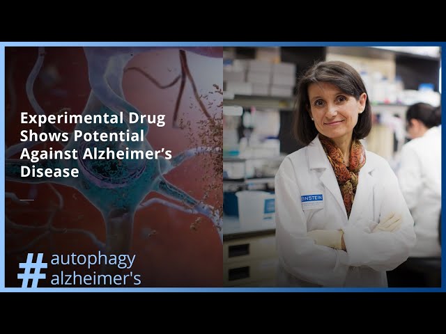 Experimental Drug Shows Potential Against Alzheimer’s Disease