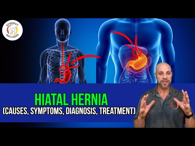Hiatal Hernia (Causes, Symptoms, Diagnosis, Treatment)