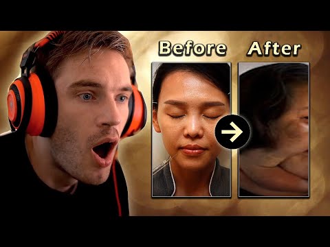 Reacting To The Worst Plastic Surgeries