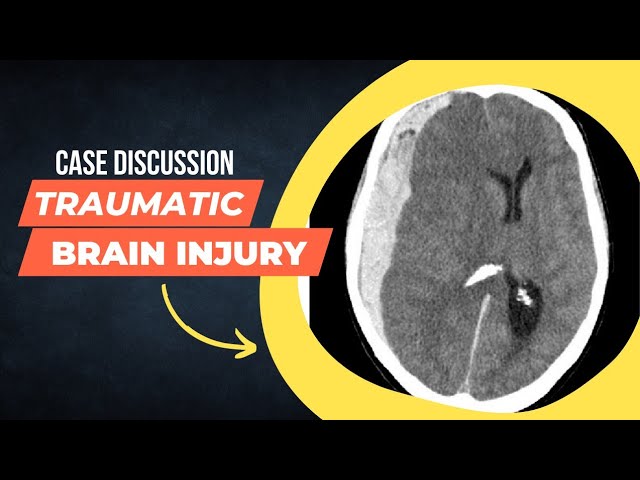 Trauma Case Discussion || Head Injury