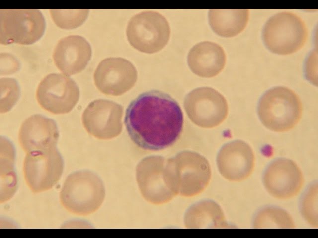 Blood 3, Blood cells.