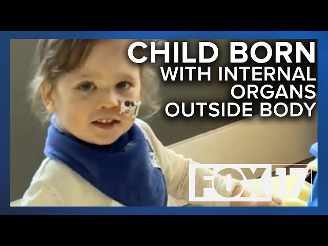 Toddler Born With Organs Outside His Body Continues To Push Boundaries