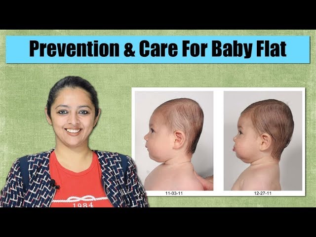 How To Maintain Baby Head Shape | Flat Head Prevention And Cure