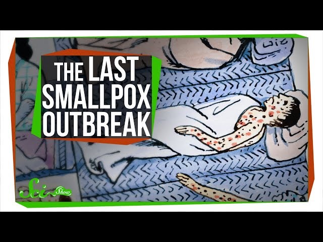The Last Major Smallpox Outbreak in America