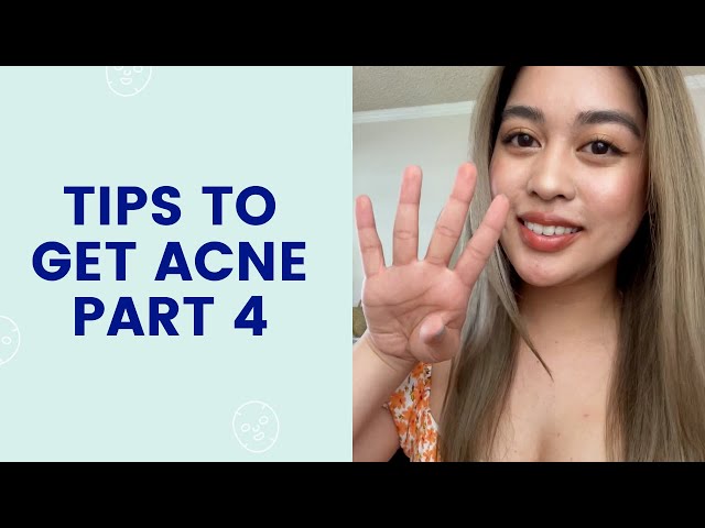 Tips To Get Acne #4 | FaceTory