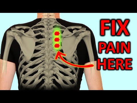 Shoulder, Rhomboid, & Arm  Pain