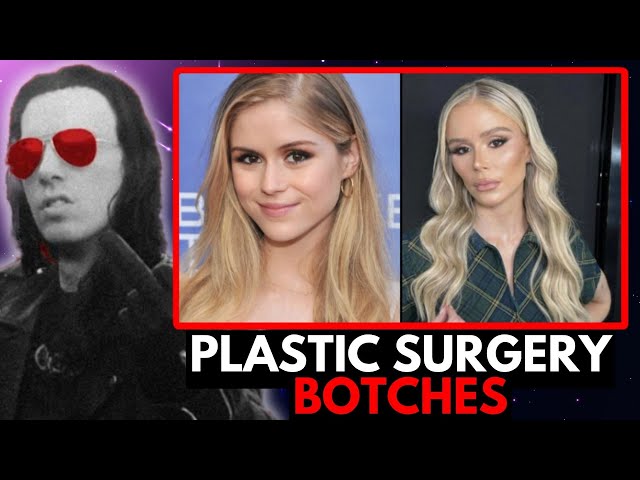 Razorfist on the Worst Plastic Surgery BOTCHES in Hollywood