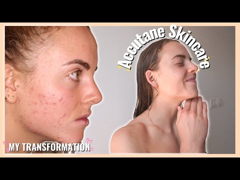 Skincare and Acne