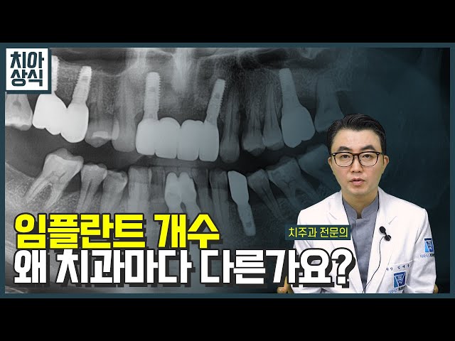 [치아상식] 임플란트 개수 왜 치과마다 다른가요?
