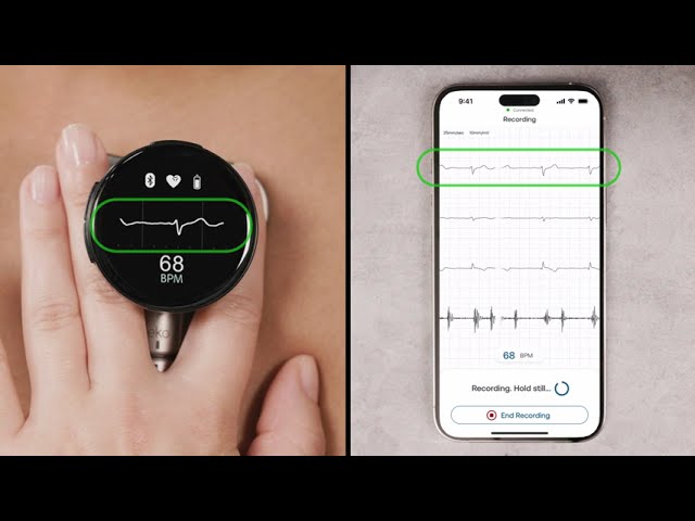 How to Capture an ECG (electrocardiogram) with the Eko CORE 500™ Digital Stethoscope