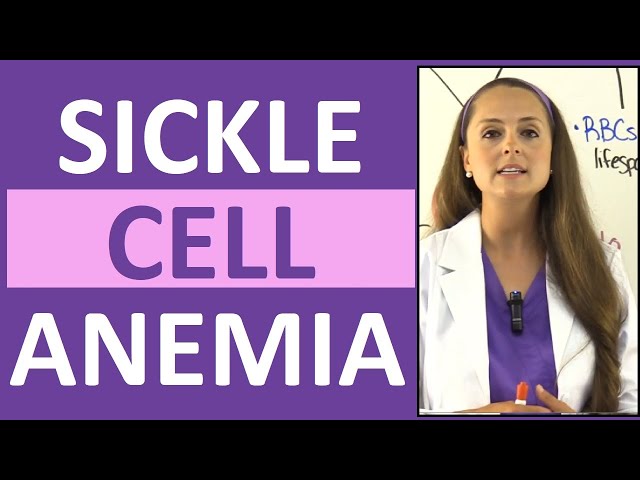 Sickle Cell Anemia Nursing | Symptoms, Pathophysiology, Sickle Cell Crisis & Trait