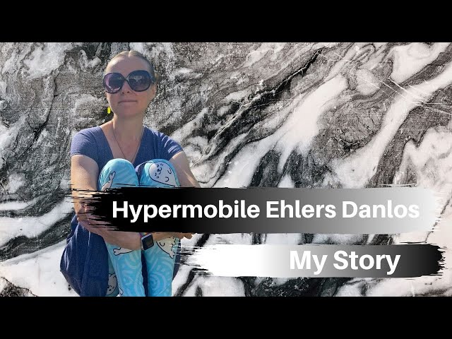 Hypermobile Ehlers Danlos Syndrome:My Story