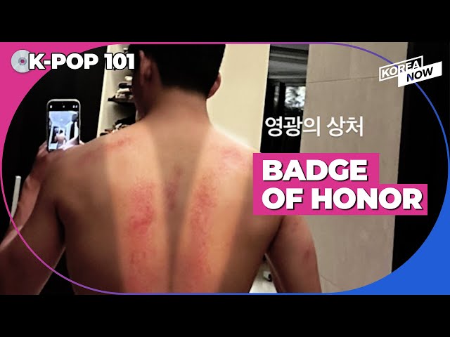 Let's find out why V has red marks on his back