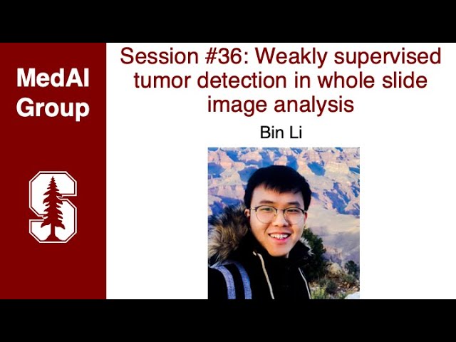 MedAI #36: Weakly supervised tumor detection in whole slide image analysis | Bin Li
