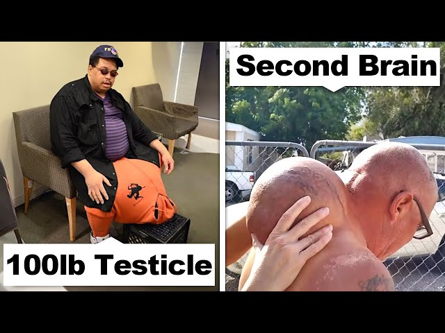 15 People Who Grow Incredible Body Parts