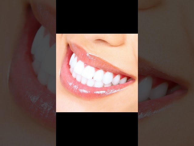 Healthy teeth healthy me | brush your teeth | Health teeth | Shanavtube | brushing teeth | teeth