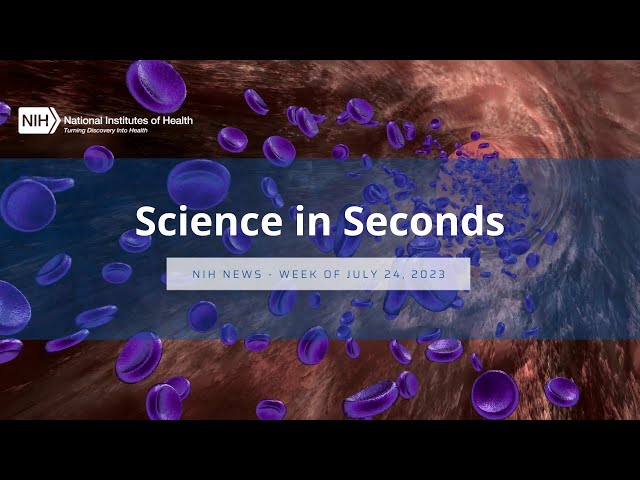 NIH Science in Seconds – Week of July 24, 2023