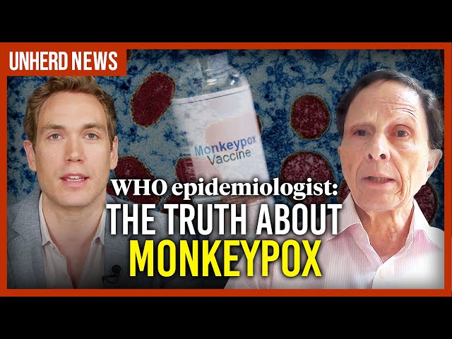WHO epidemiologist: The truth about monkeypox