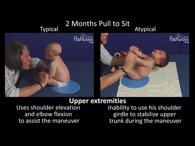 2 Month Old Baby Typical & Atypical Development Side by Side