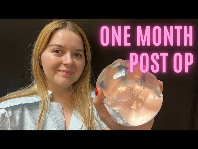 Breast Augmentation 1 Month Post Op Update! Implant Exchange with a Lift Surgery