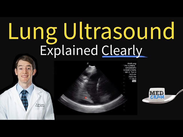 Lung Ultrasound Explained (Point of Care, Bedside, Clinical)