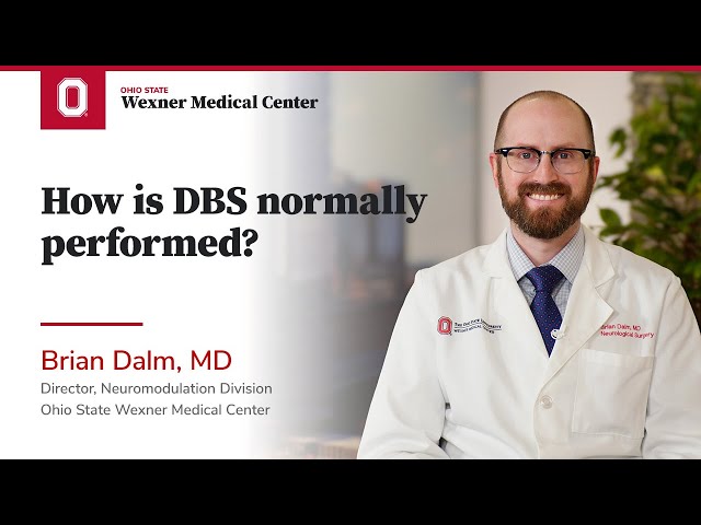 How is DBS normally performed? | Ohio State Medical Center