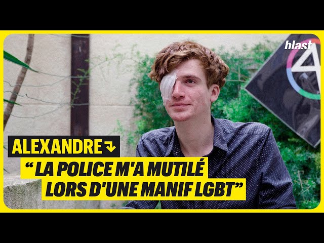 ALEXANDRE : "LA POLICE M'A MUTILÉ LORS D'UNE MANIF LGBT"