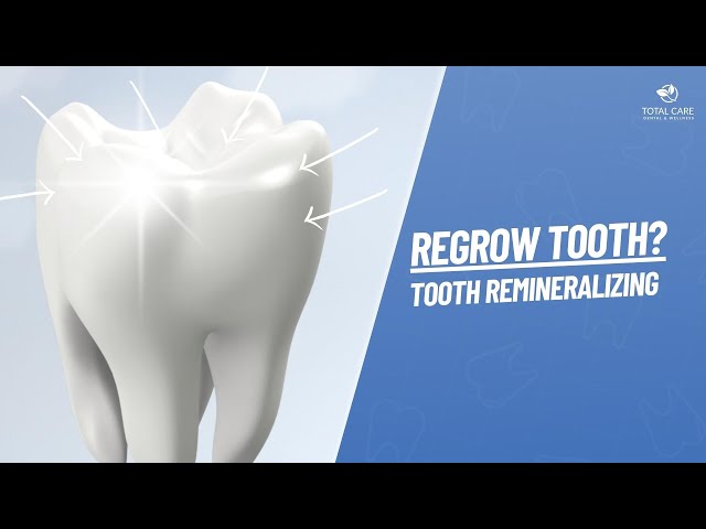 Regrowing or Re-Mineralizing Teeth
