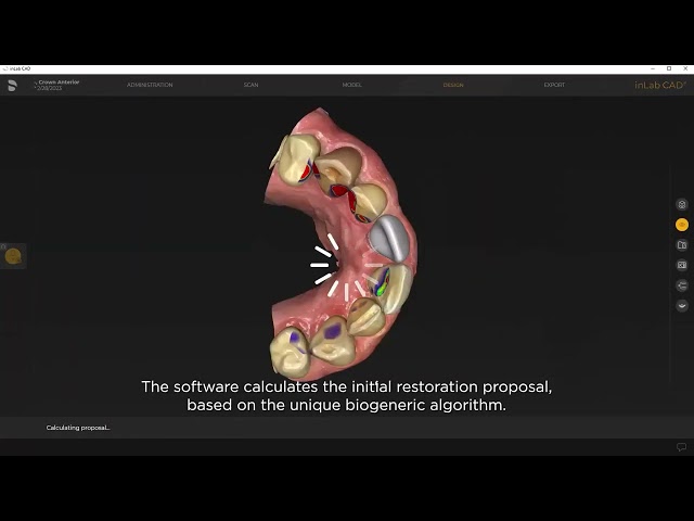 Primemill with inLab Software chairside workflow: creating an anterior crown